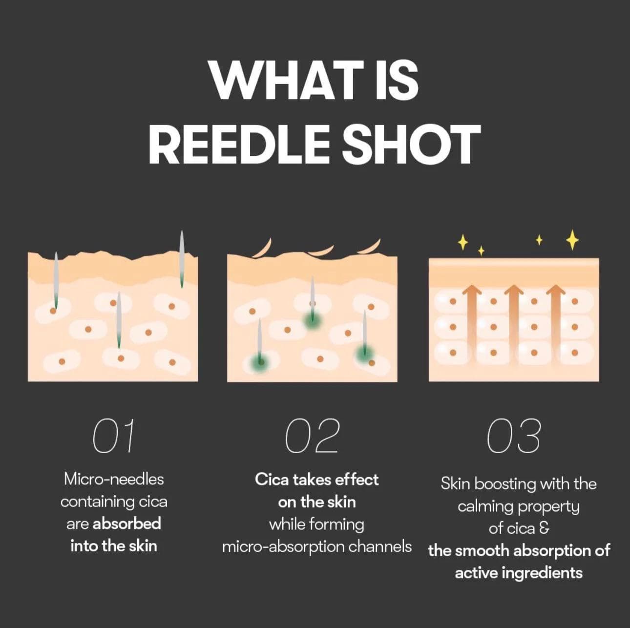 What is VT Reedle Shot